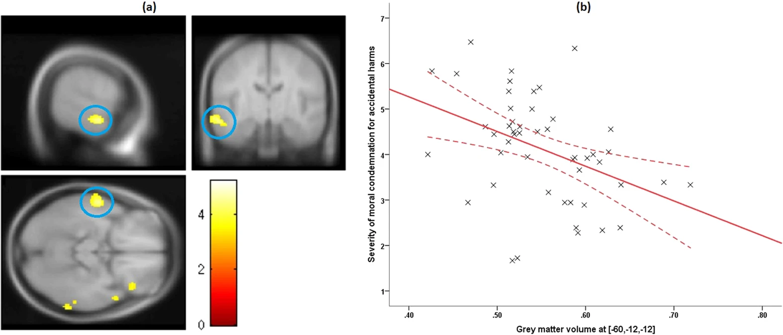 Voxel-based morphometry results