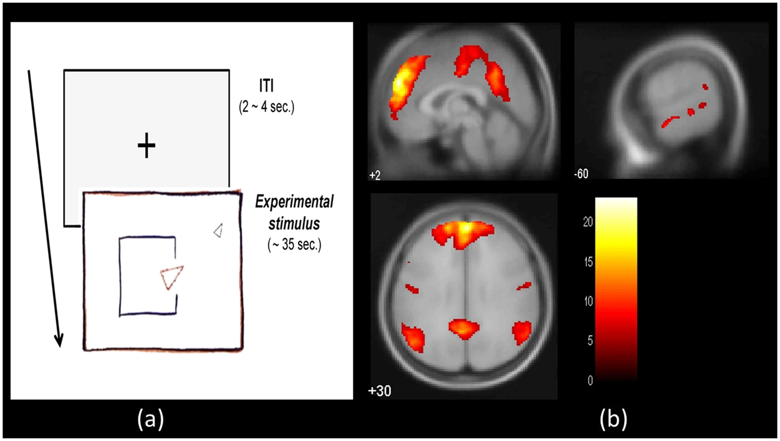 Theory of mind network activation