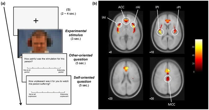 Empathy localiser fMRI activation map